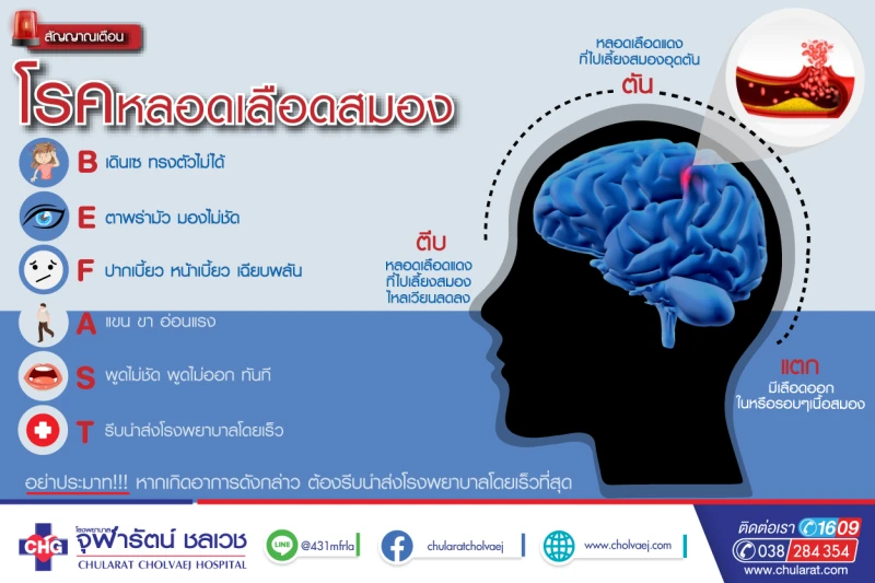 อย่าประมาท !! ตีบ ตัน แตก ตาย