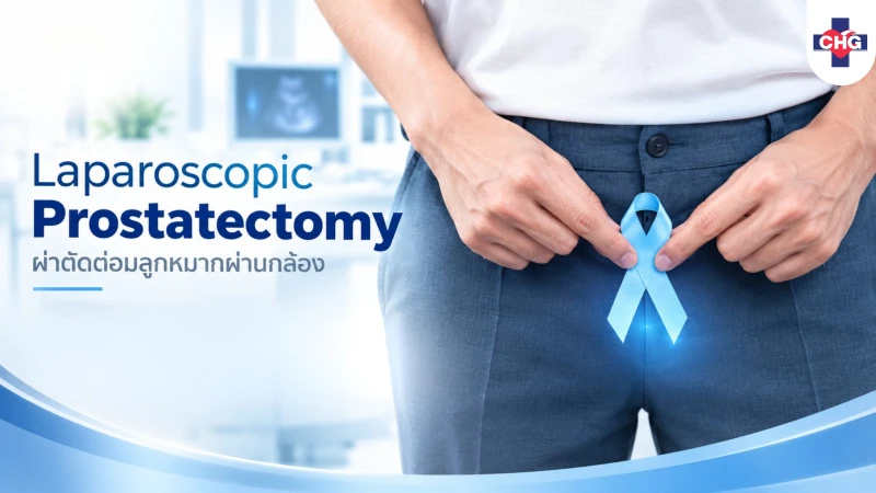 การผ่าตัดต่อมลูกหมากแบบส่องกล้อง Laparoscopic Prostatectomy