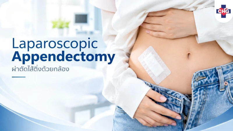 การผ่าตัดไส้ติ่งผ่านกล้อง Laparoscopic Appendectomy