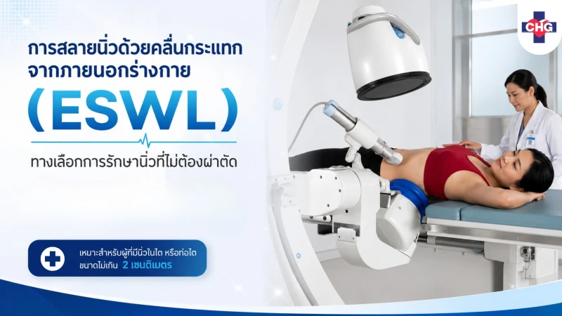 การสลายนิ่วด้วยคลื่นกระแทกจากภายนอกร่างกาย (ESWL): ทางเลือกการรักษานิ่วที่ไม่ต้องผ่าตัด