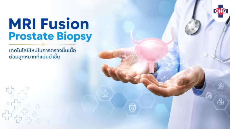 MRI Fusion Prostate Biopsy เทคโนโลยีใหม่ในการตรวจชิ้นเนื้อต่อมลูกหมากที่แม่นยำขึ้น