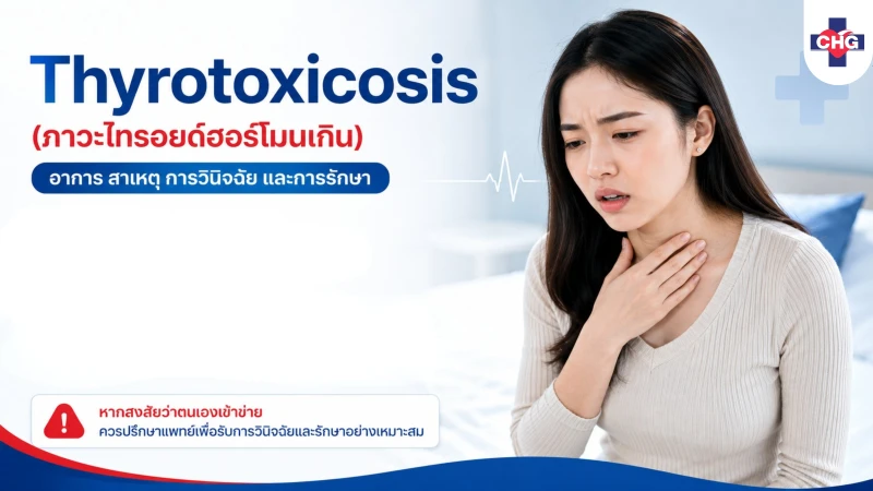 Thyrotoxicosis (ภาวะไทรอยด์ฮอร์โมนเกิน): อาการ สาเหตุ การวินิจฉัย และการรักษา