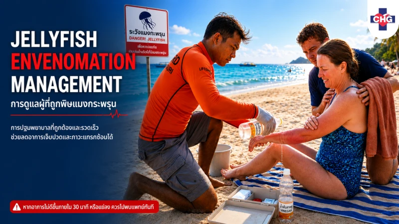แนวทางการจัดการภาวะเป็นพิษจากแมงกะพรุน การปฐมพยาบาลที่ถูกต้องและรวดเร็วช่วยลดอาการเจ็บปวดและภาวะแทรกซ้อน