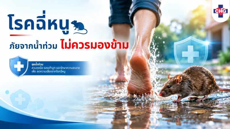 โรคฉี่หนู ภัยจากน้ำท่วมที่ไม่ควรมองข้าม